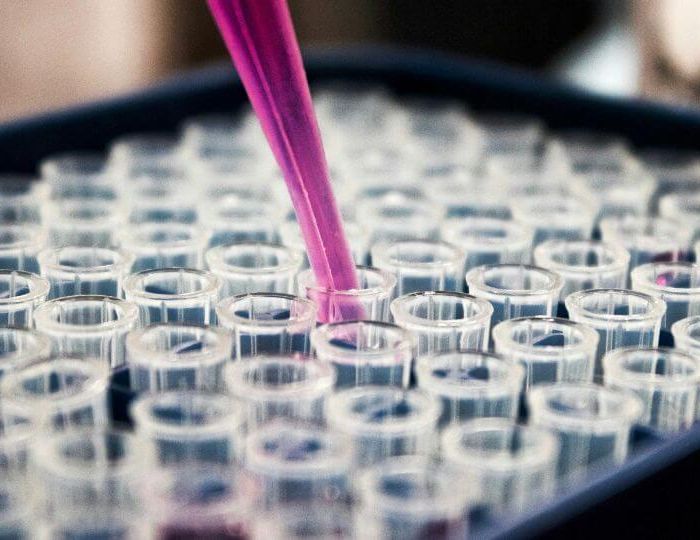 Medicininiai vertimai: kaip užtikrinamas tikslumas medicinos įrangos dokumentacijoje